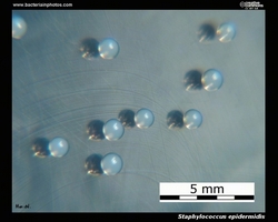 s.epidermidis colonies on tryptic soy agar